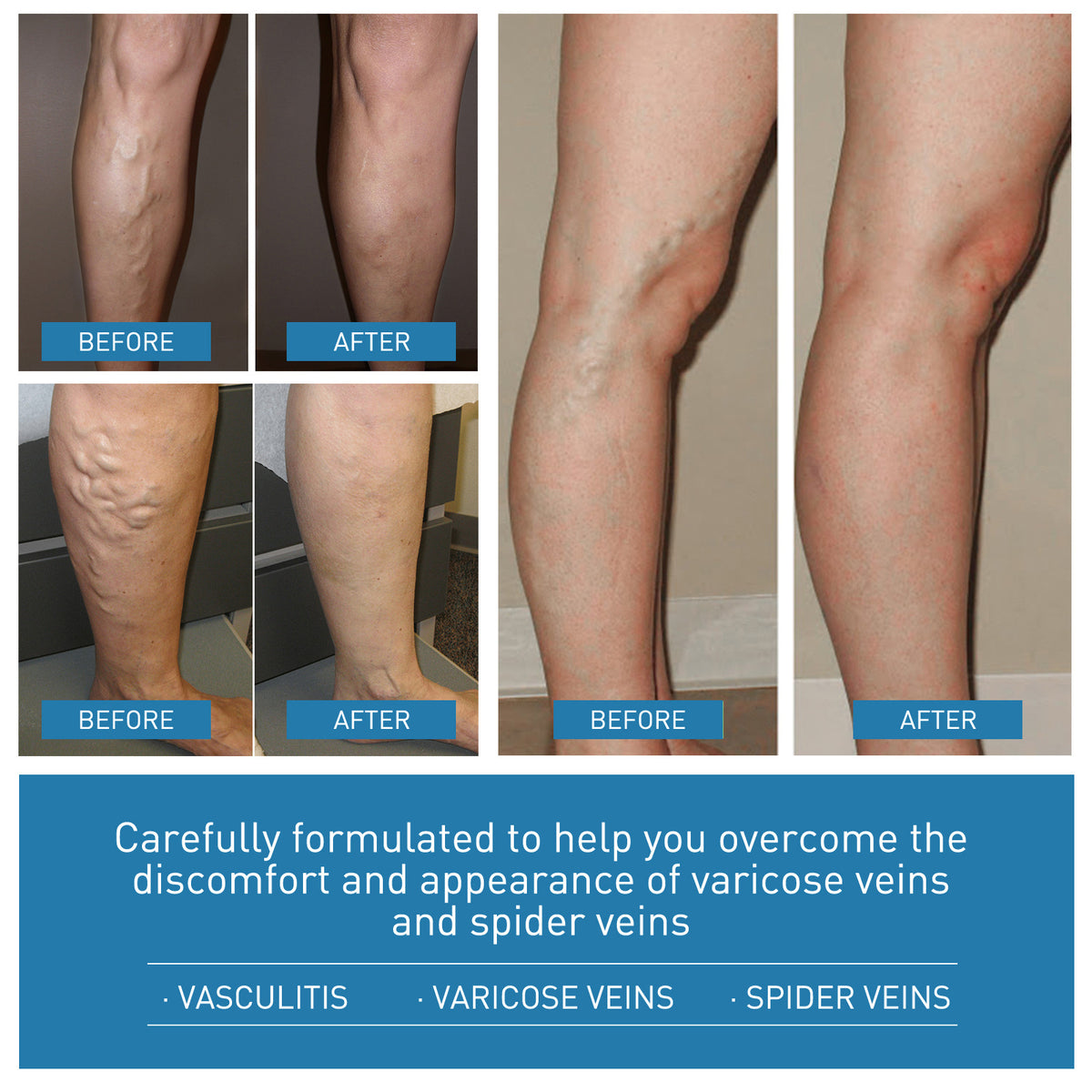 Ouhoe Intravenous Nourishing Cream Relieve Leg Leg Massage Soreness Maikang Neck Cream