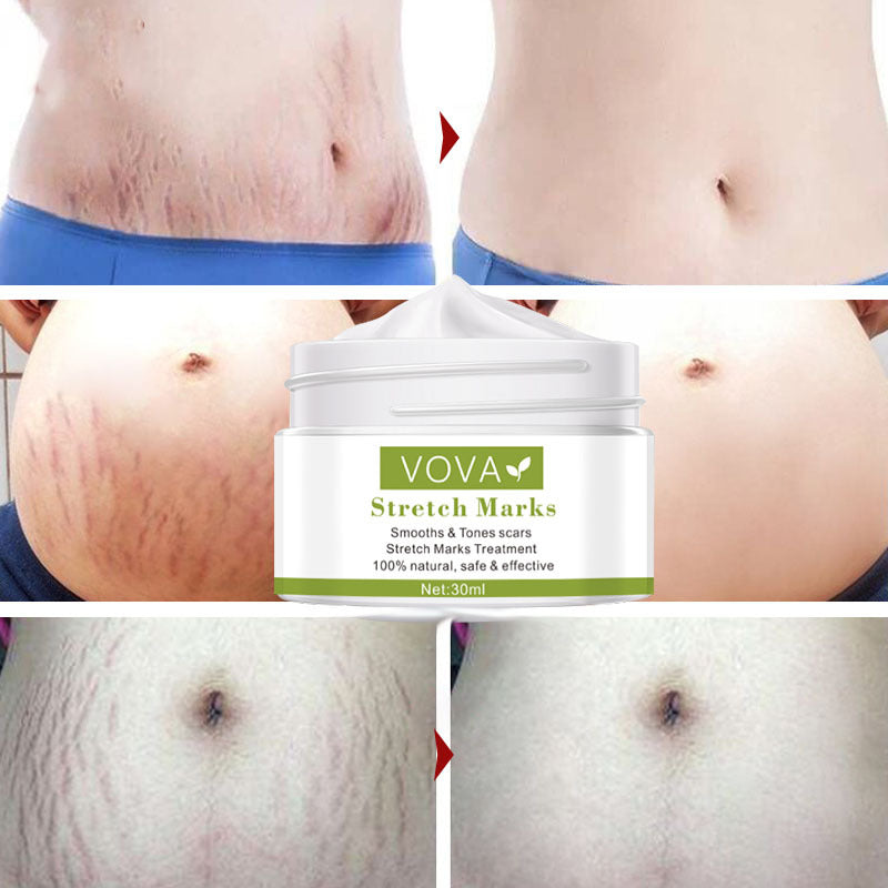 Vova Stretch Marks Pure Color Cream 30ml