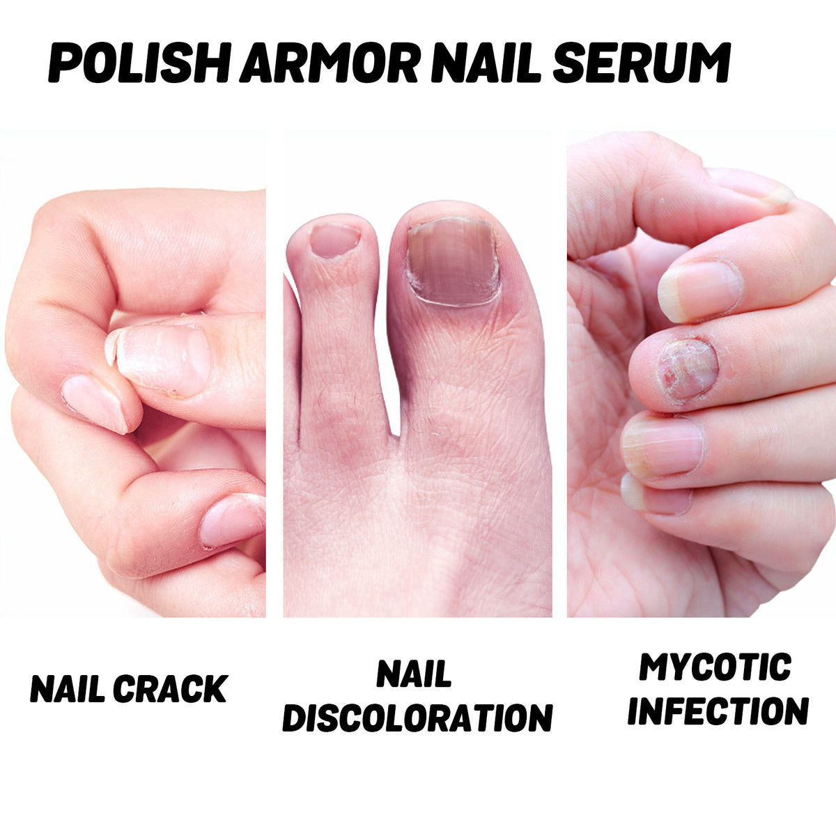 Ouhoe Nursing Nourishing Nail Saver Beauty