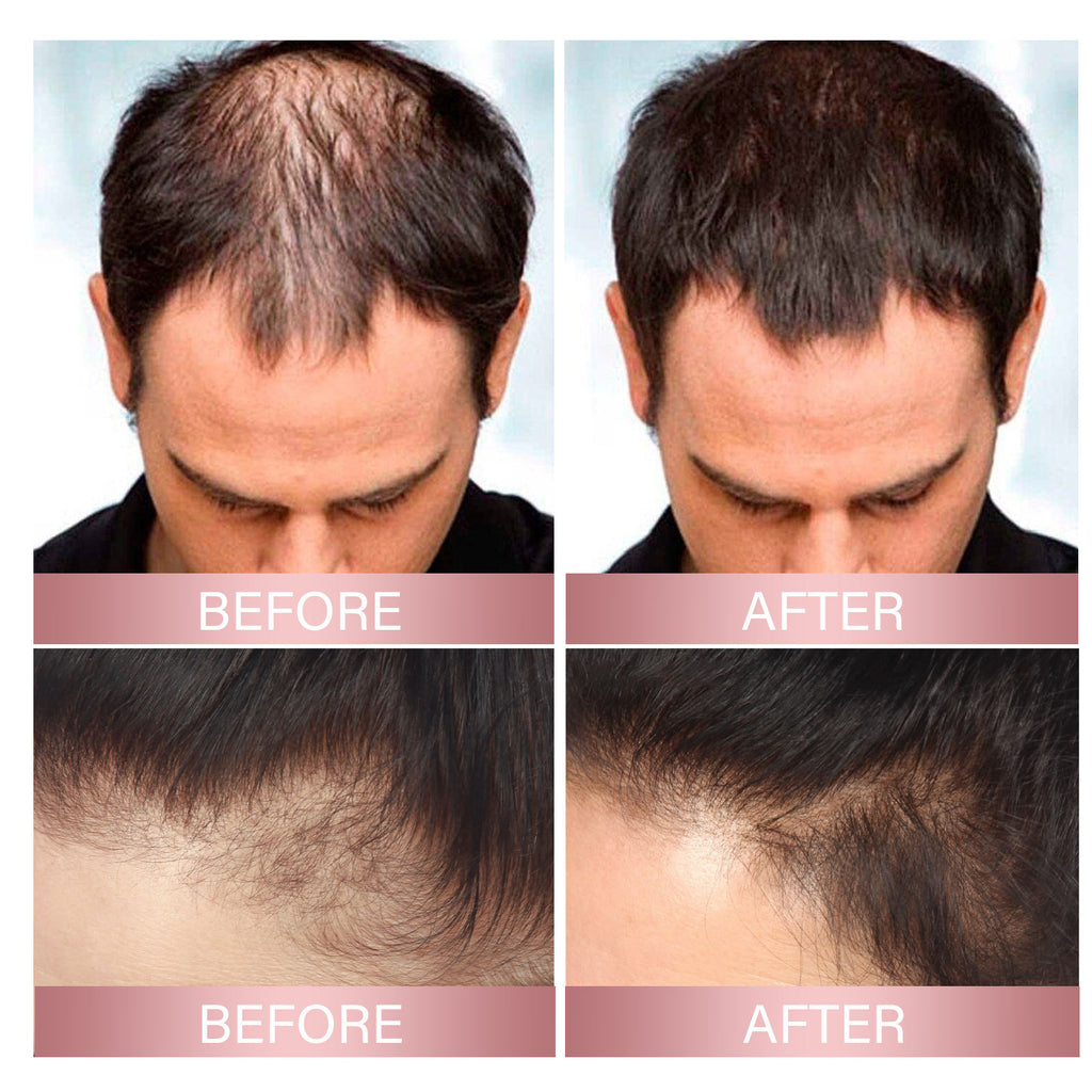Eelhoe Strong Nourishing Rice Dense Hair Spray Hair Follicle Hair Root Anti-drop