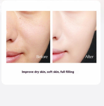 Chun'DY Fade Black Blemish Marks Cream Brightening And Removing Yellow Improve Brightening Cream