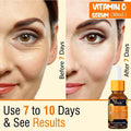 Oneway Happiness Vitamin C Face Serum 30Ml- Skin Clearing Serum (Pack Of 2)
