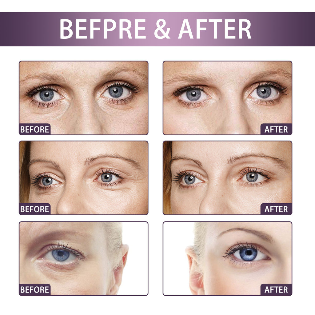 Eelhoe Lifting Firming Moisturizing And Lightening Eye Care Cream