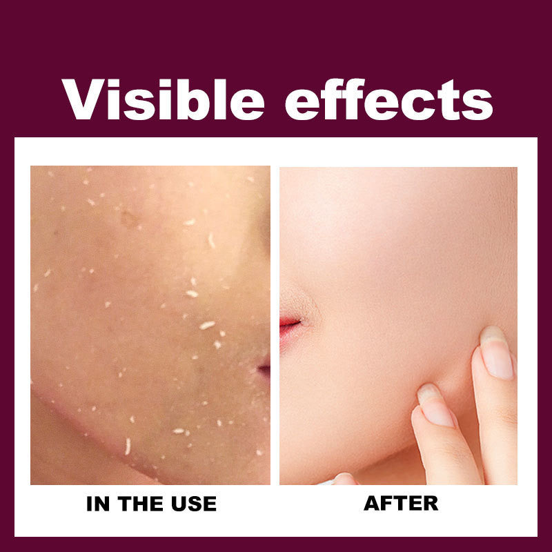 RtopR Exfoliating Gel Cream