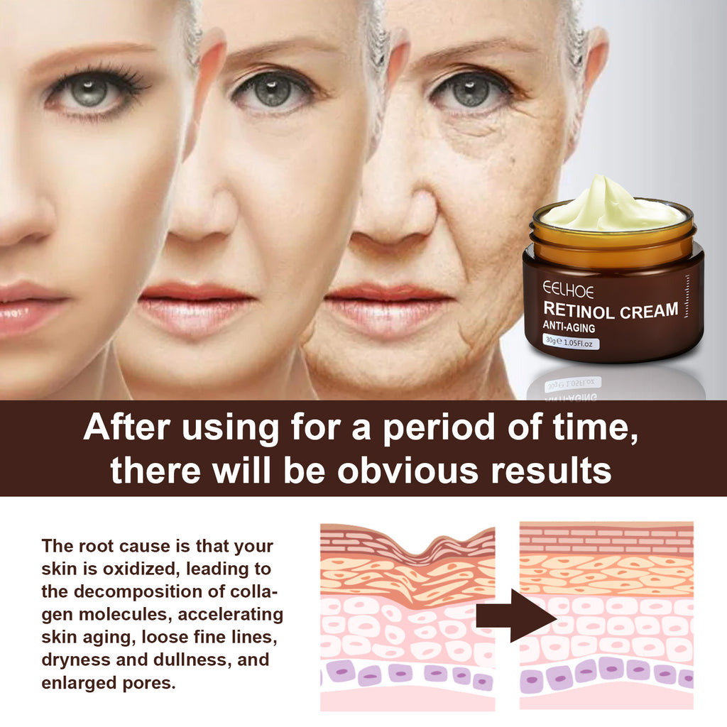 Eelhoe Retinol Hydrating Firming Lifting Brightening Cream