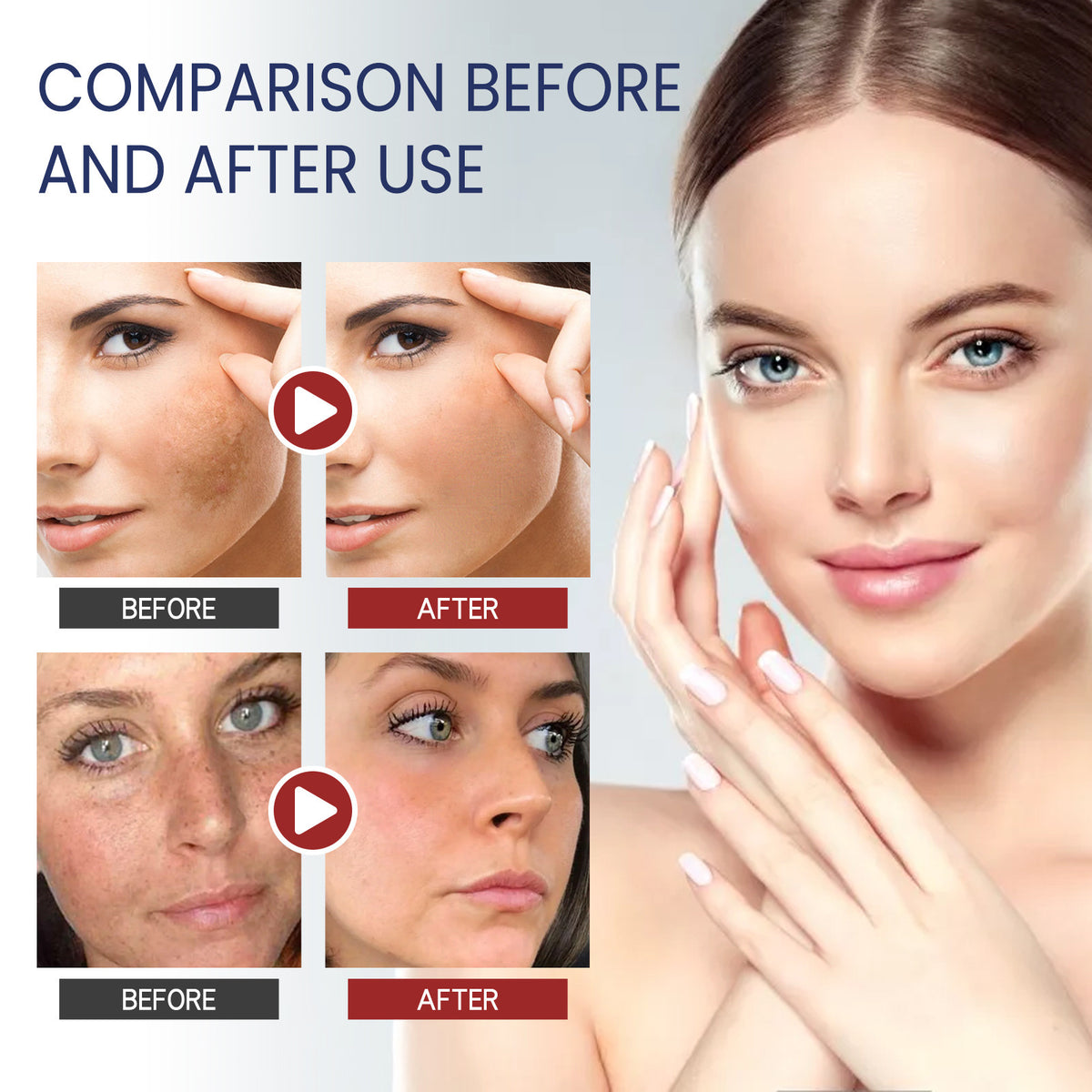 Hoygi Fade Spots Softening Skin Moisturizing Cream