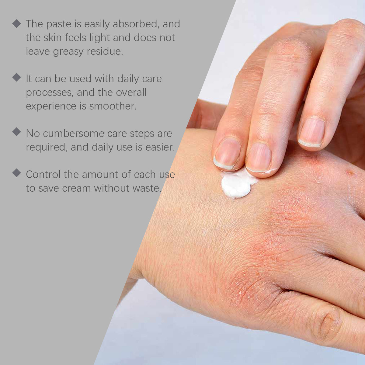 Ximonth Skin Neck Cream Gentle And Soothing