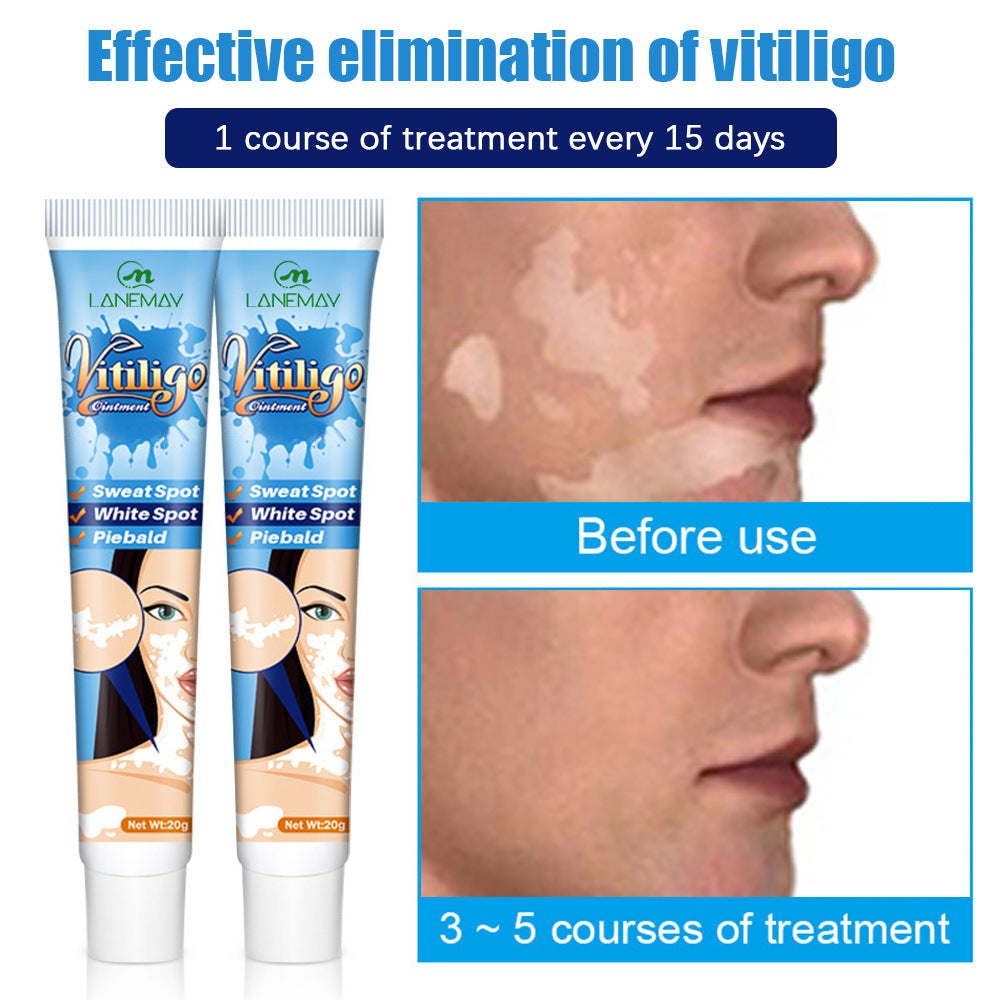 Lanemay Vitiligo Sweat Spotted Skin Care Nourishing Cream