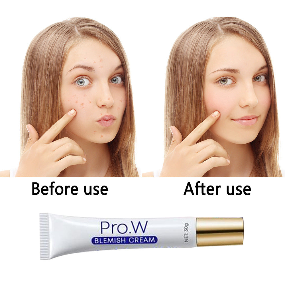 Pro.W Brightening and freckle removing cream
