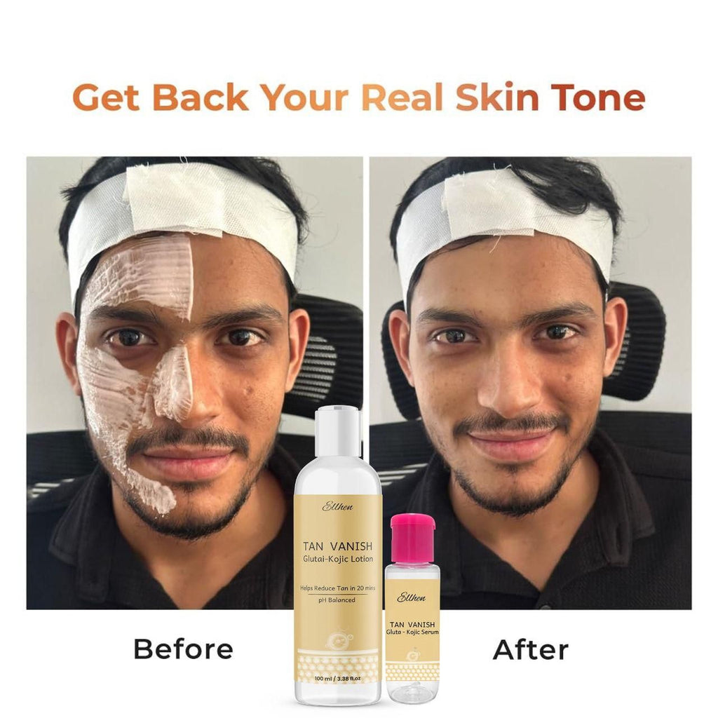 Euhen Tan Vanish Glutai Kojic Lotion and Gluta Kojic Serum 100 ml