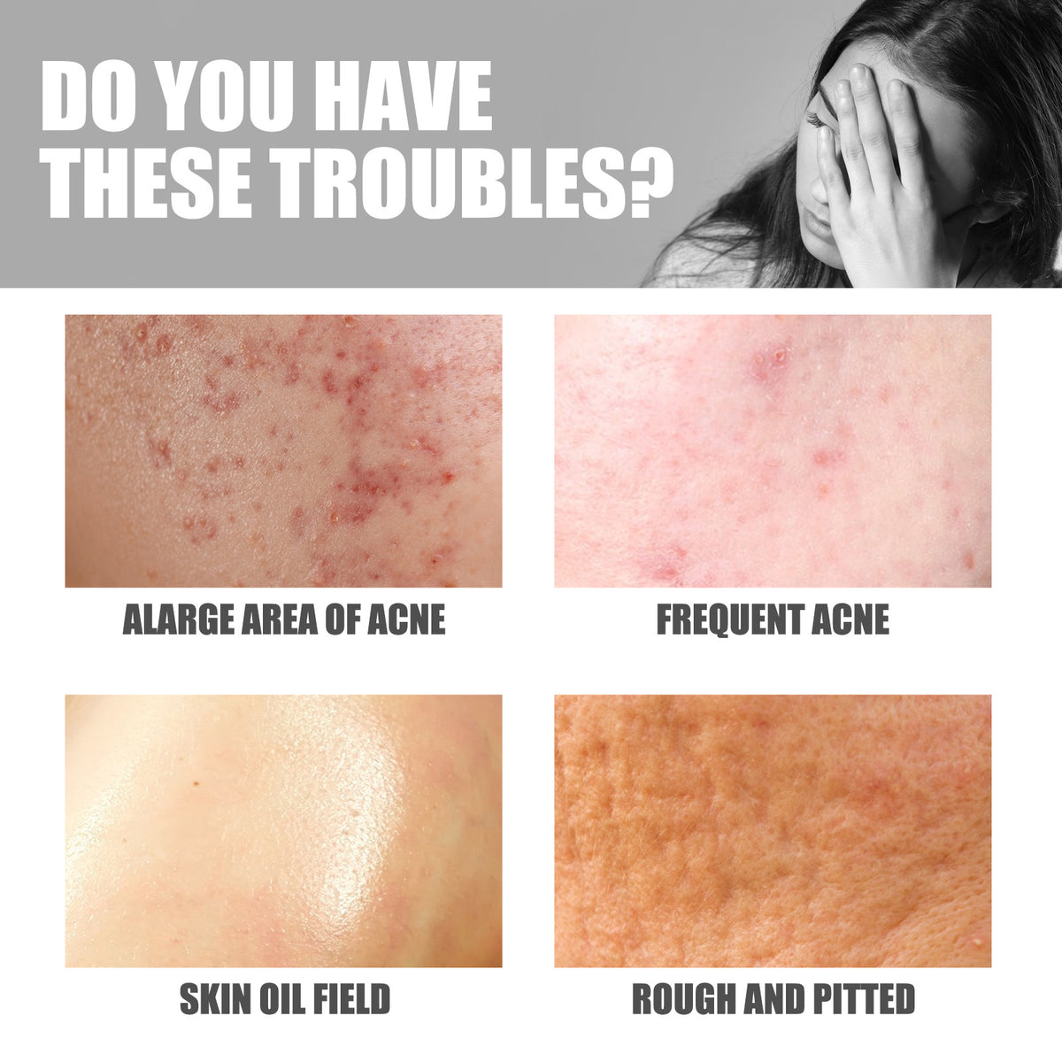 Jaysuing Hip Neck Cream Moisturizing Smallpox Diluting