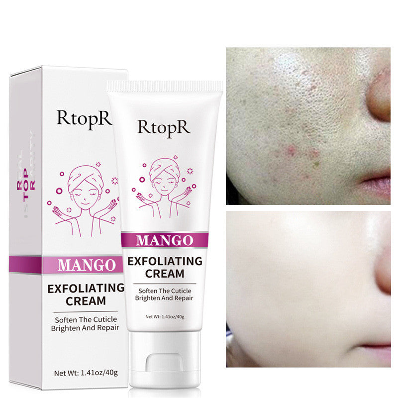 RtopR Exfoliating Gel Cream
