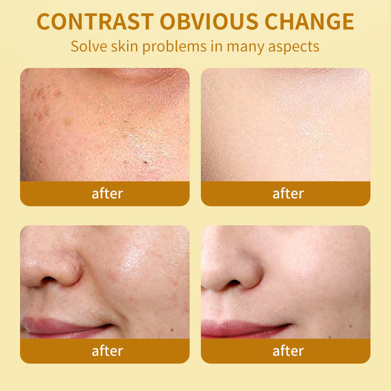 Turmeric Moisturizing Anti-oxygen Nourishing Moisturizing Cream