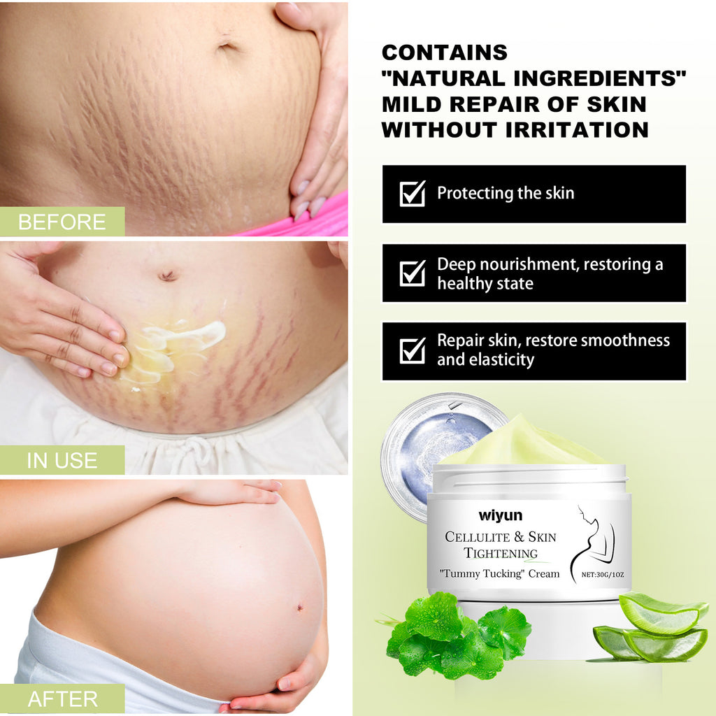 Wiyun Skin Mark Pregnancy Wound Skin Nourishing Cream