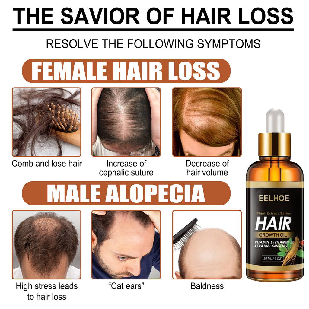 EELHOE Herb Hair Hairdressing Hair Care Essential Oil Hair Strong Hair Reduce Hair Care Broken Hair Hair Care Essential Oil