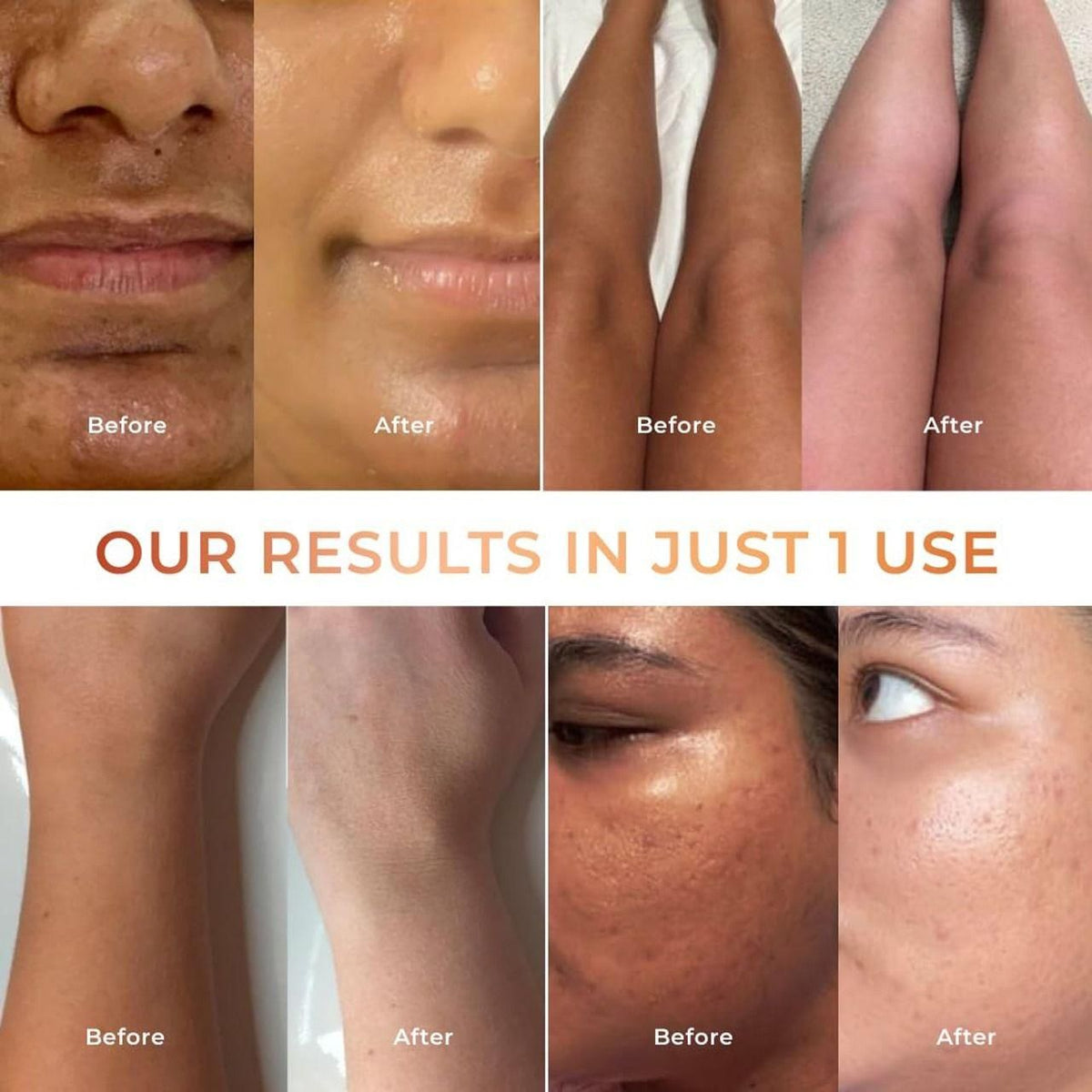 Euhen Tan Vanish Glutai Kojic Lotion and Gluta Kojic Serum 100 ml