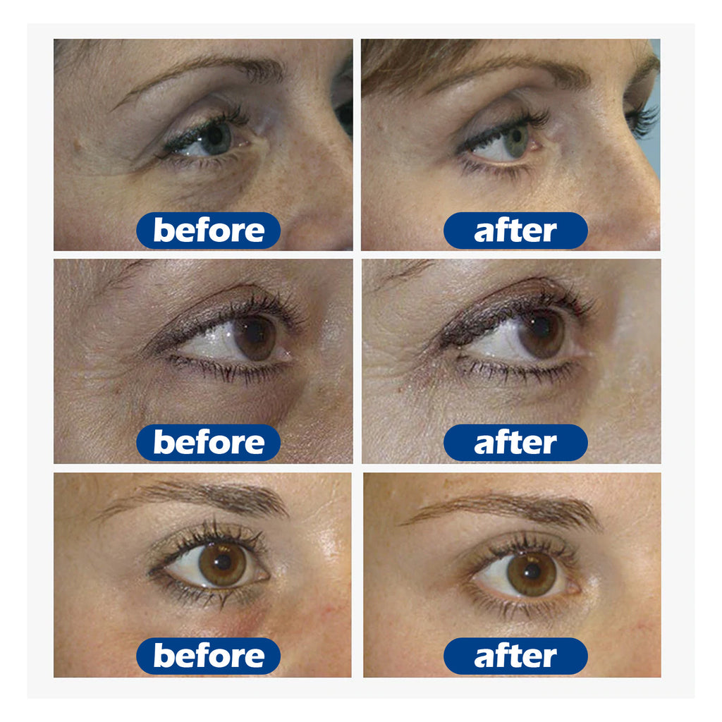 Eelhoe Collagen Dark Circles Eye Cream