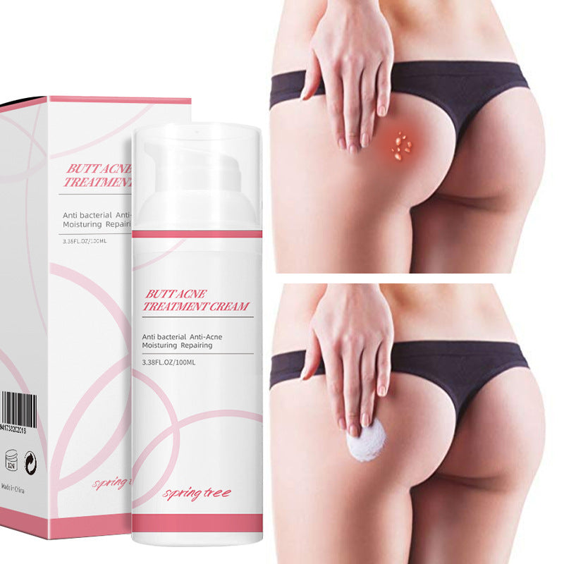 Spring Tree Blemish Cream For Buttocks Blemish Cream For Foreign Trade Only Amazon