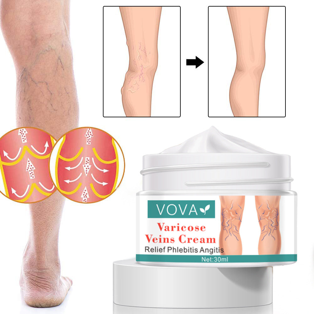 Vova Spider Leg Varicose Vein Nourishing Cream