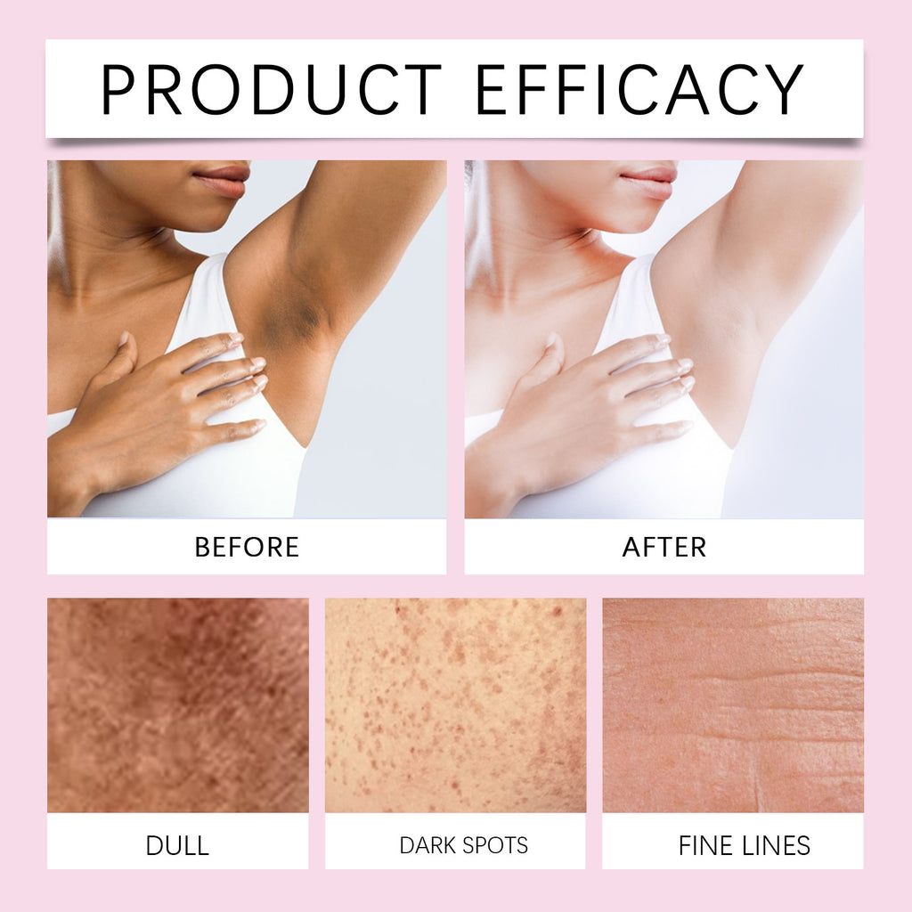Hoygi Body Black Spot Correction Cream Brightening Skin