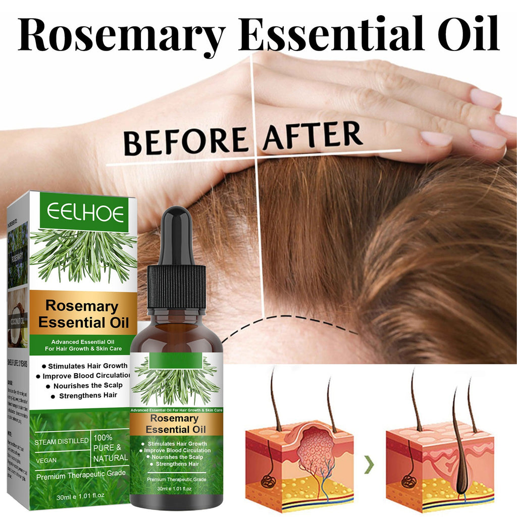 Eelhoe Rosemary Hair Care Essential Oil Anti-loss Hair Growth Hair Care Nourish Scalp Hair Roots