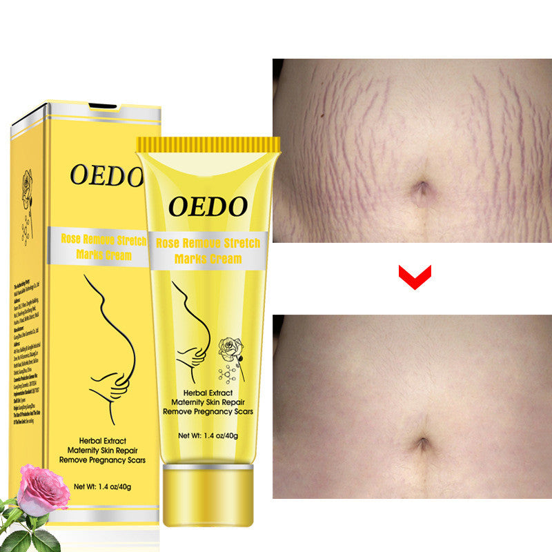 Edeo Rose Stretch Mark Removal Cream Anti-Wrinkle