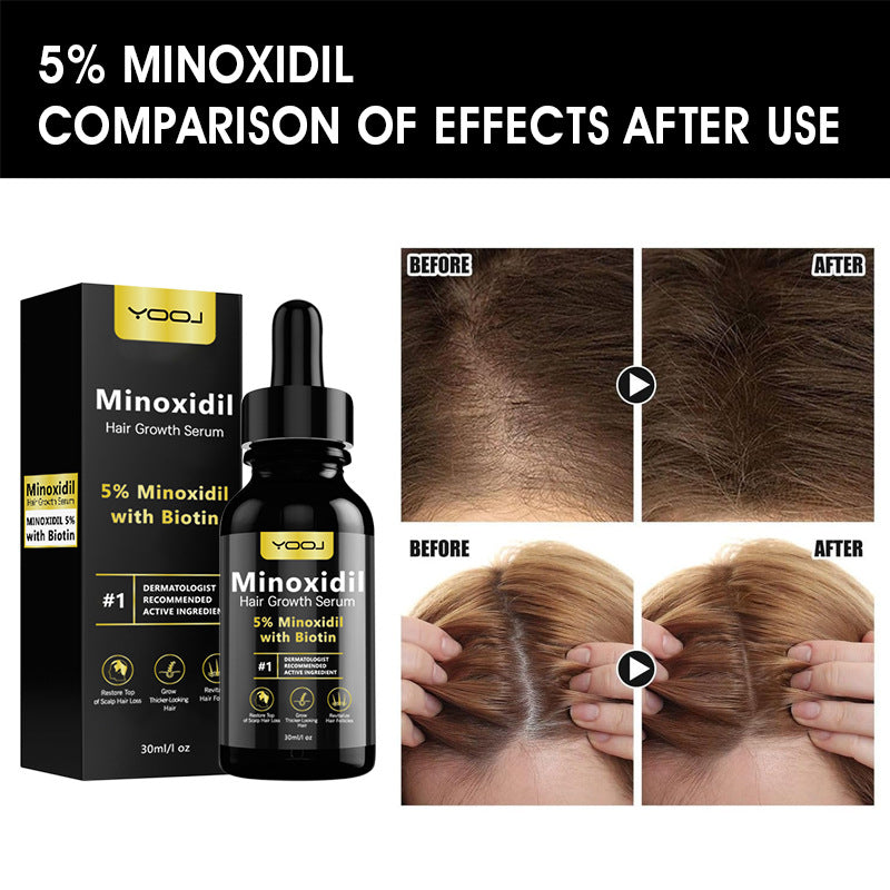 Yooj Minoxidil Nourishing Styling Cream