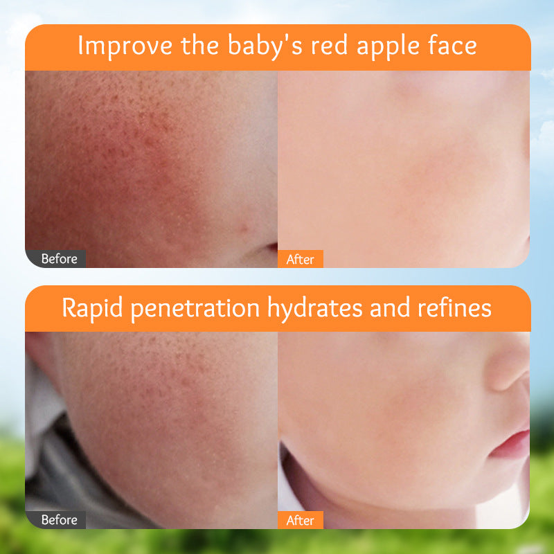 Sadoer English Marigold Children's Moisturizing Facial Cream
