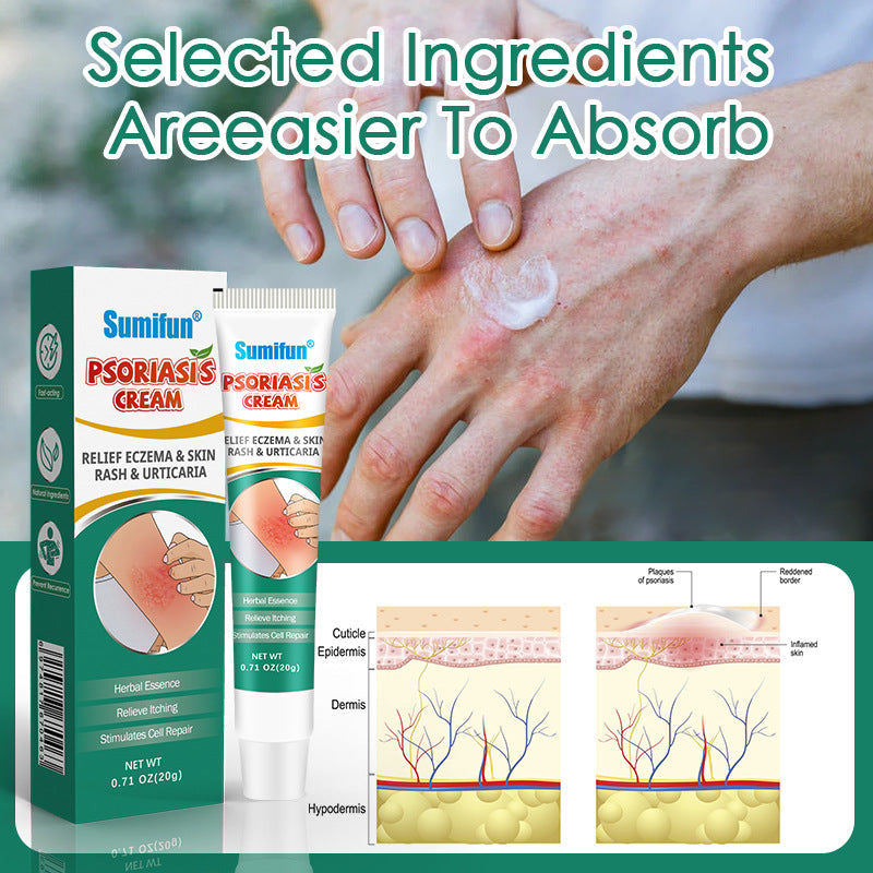 Sumifun Psoriasis Cream Relieve Dermatitis Eczema YI Bacteria Anti-Soothinging Cream