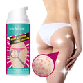 Sauvasine Hip And Leg Blemish Cream Moisturizing