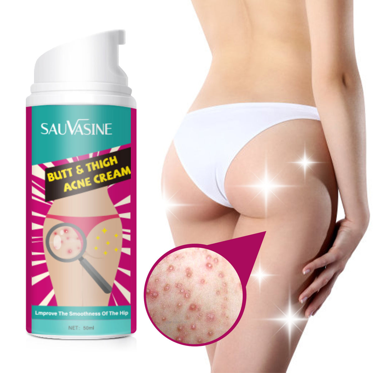 Sauvasine Hip And Leg Blemish Cream Moisturizing