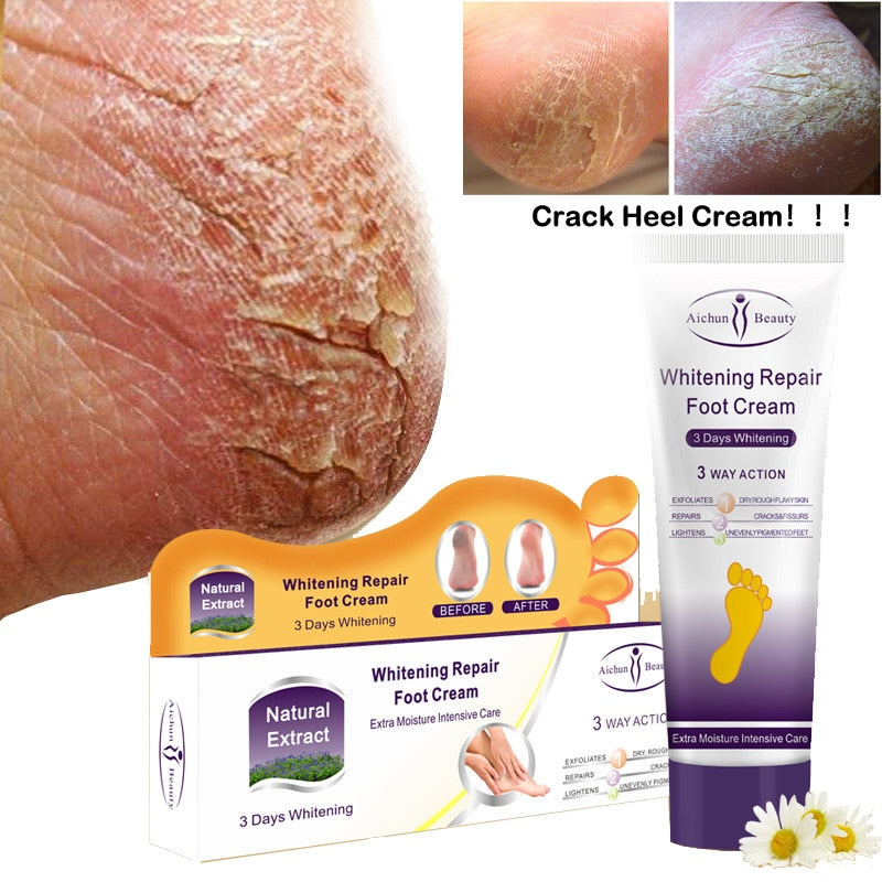 Aichun Cracked Heel Nourishing Cream
