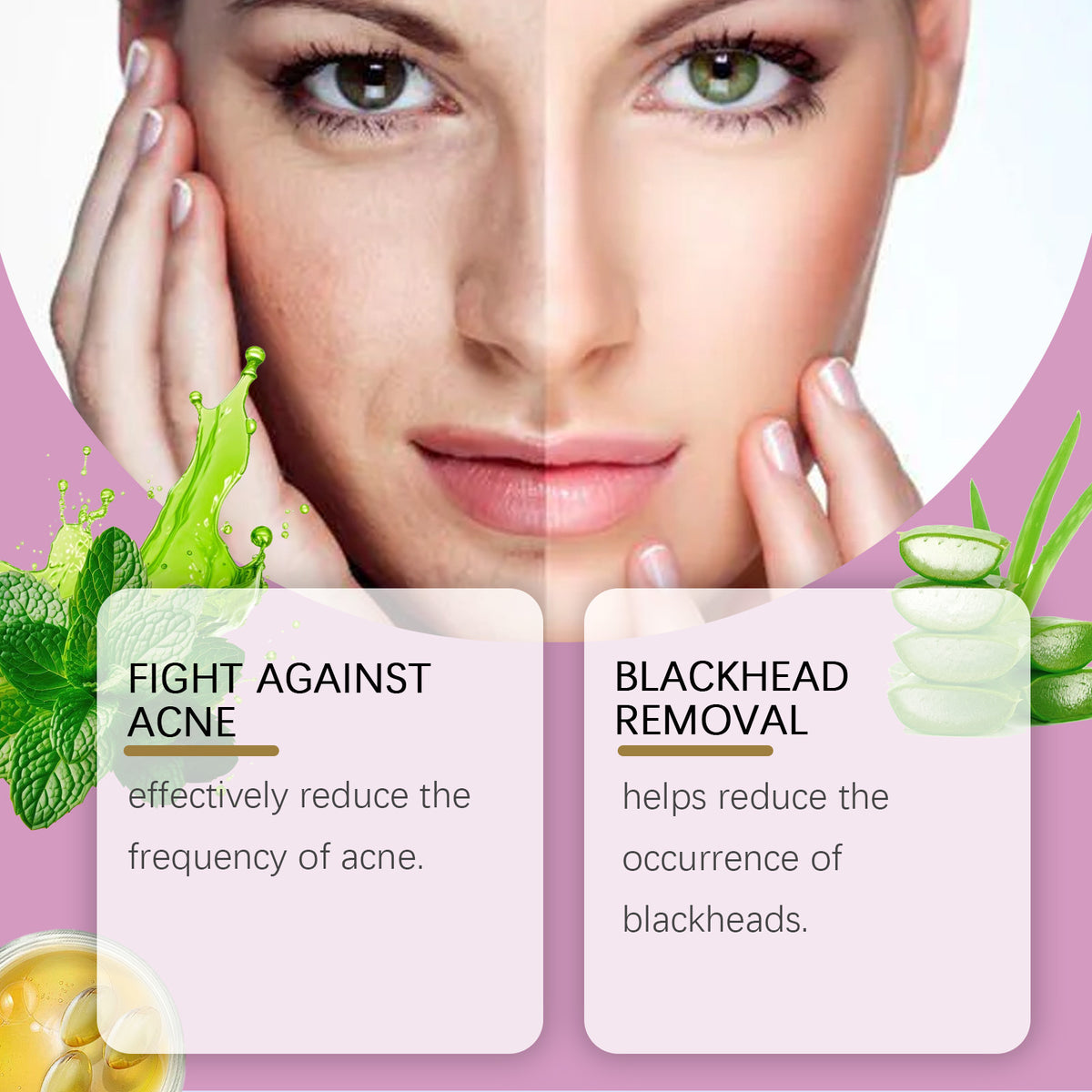 Eelhoe Mild Improvement Of Salicylate Blemish Cream