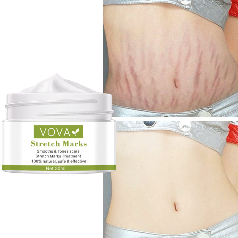 Vova Stretch Marks Pure Color Cream 30ml