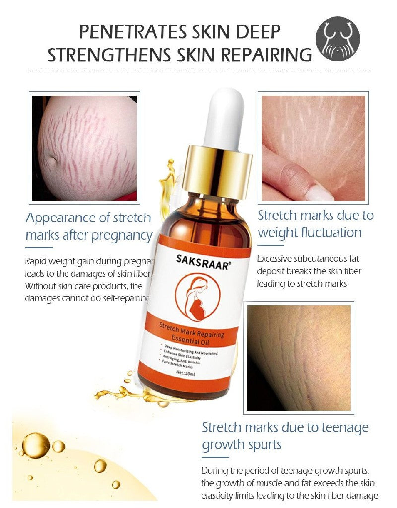 Saksraar tretch Mark Remover Essential Oil Care Cream