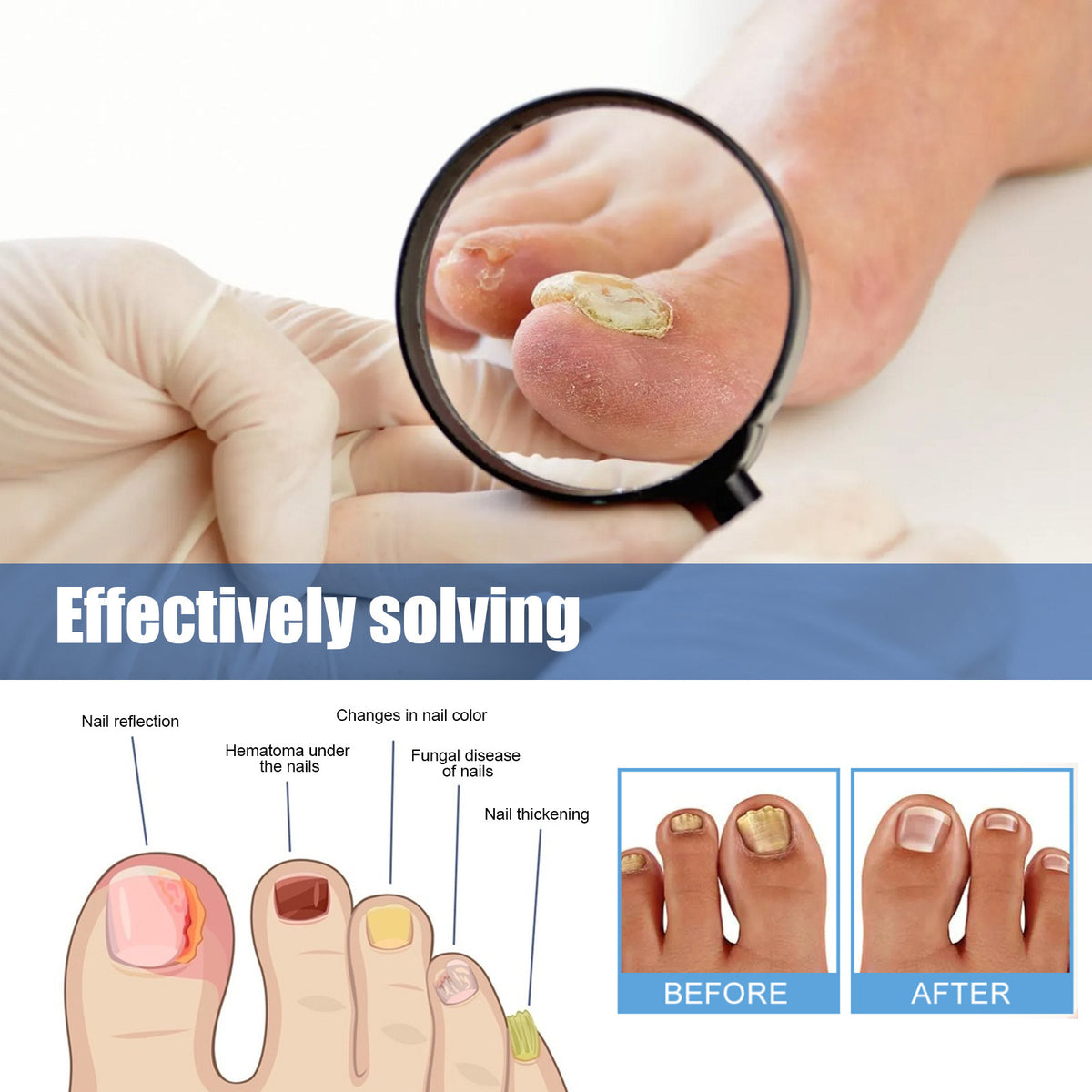 Ximonth Nail Nursing Adhesive Bandage Nourishing