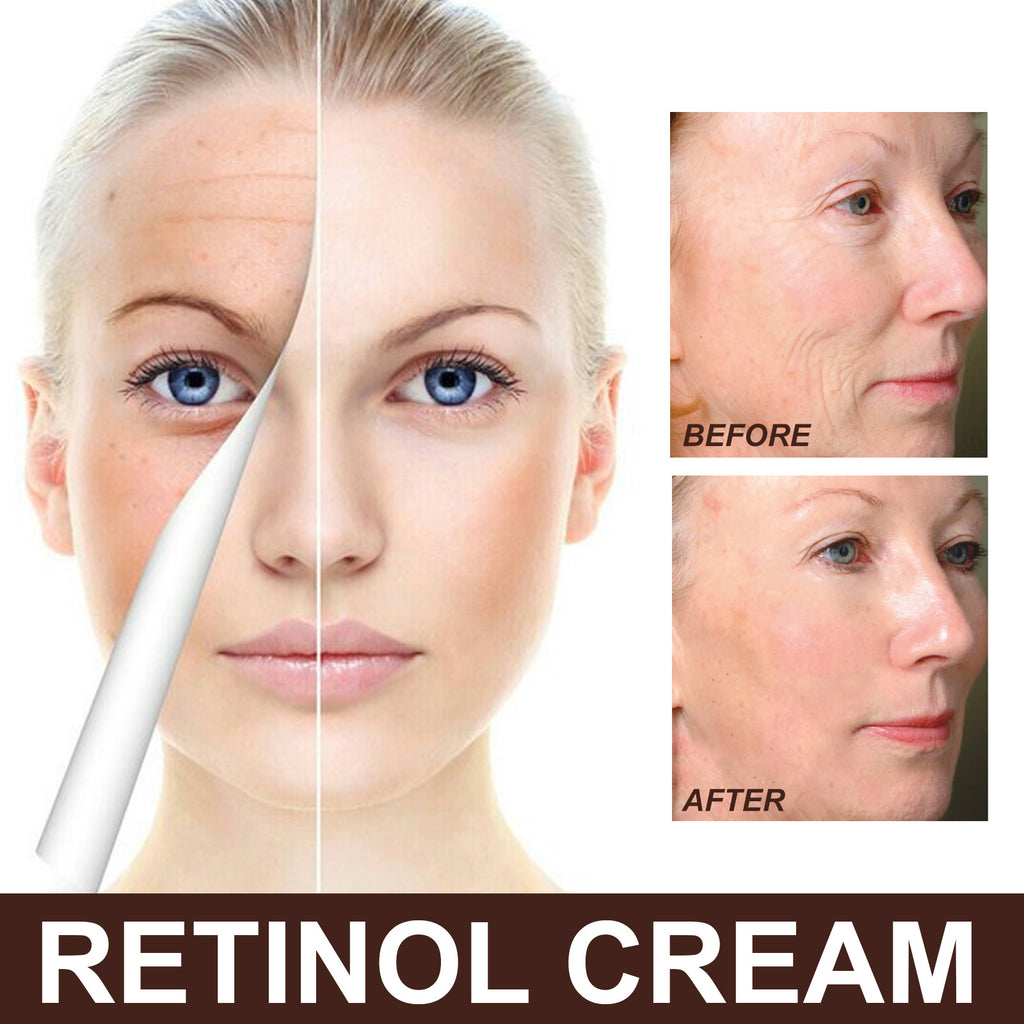 Eelhoe Retinol Hydrating Firming Lifting Brightening Cream