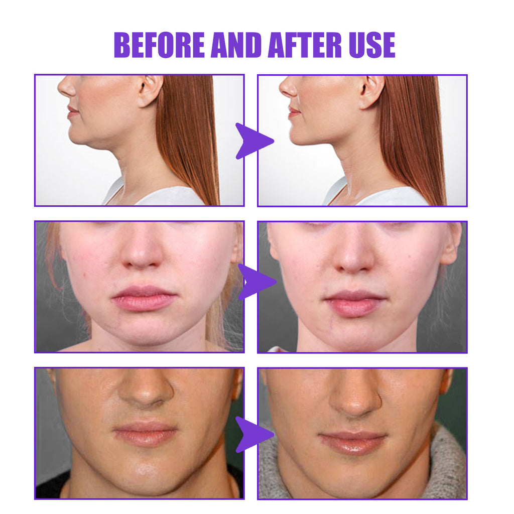 Firming Micro-Face Tighten The Contour Lift And Tighten The Chin Face Skin Sagging Massage Cream