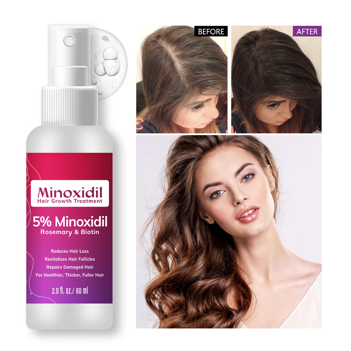 Minoxidil Anti-hair Loss Nourishing Hair Root Massage Hair Care Spray
