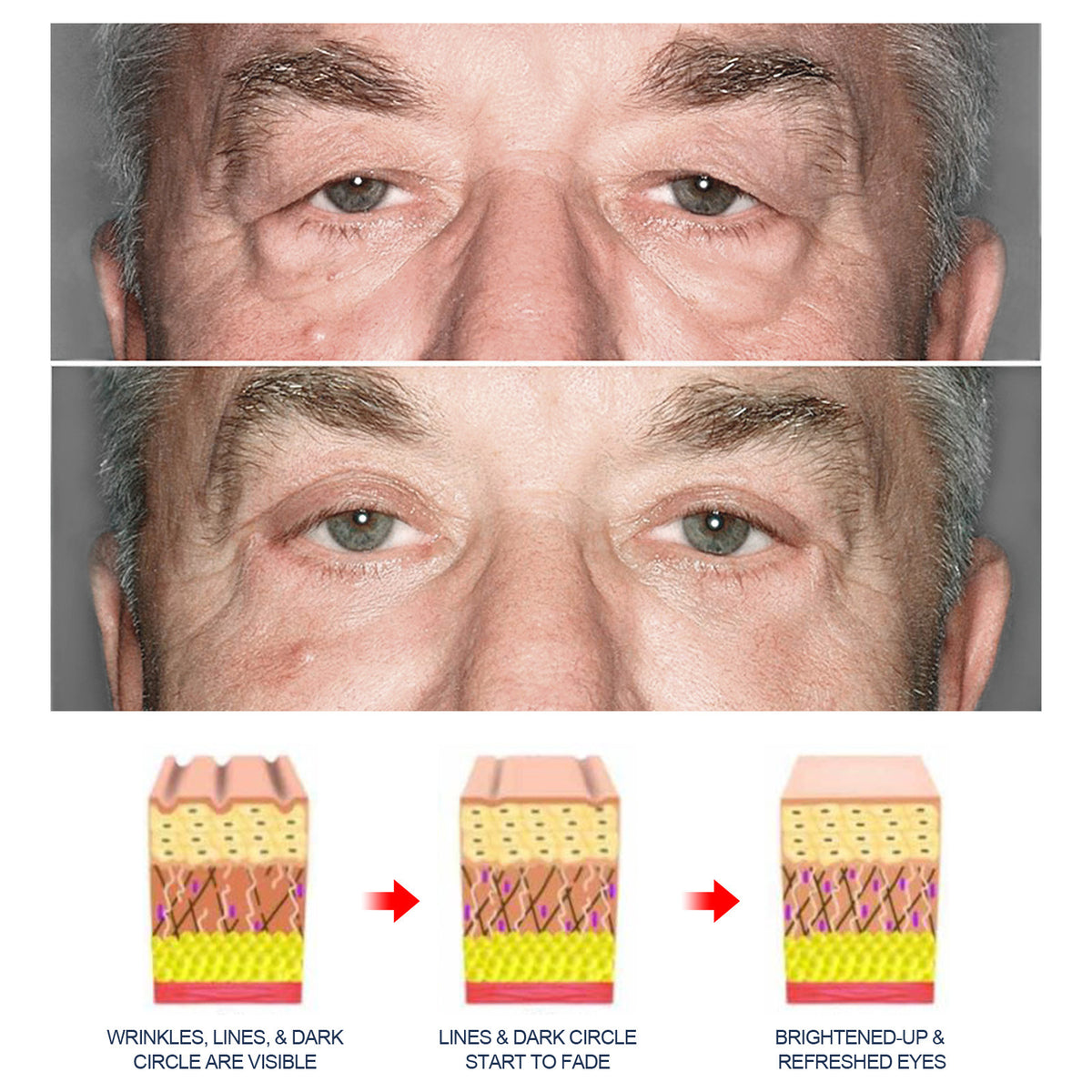 Openeyes Men's Anti-aging Eye Cream