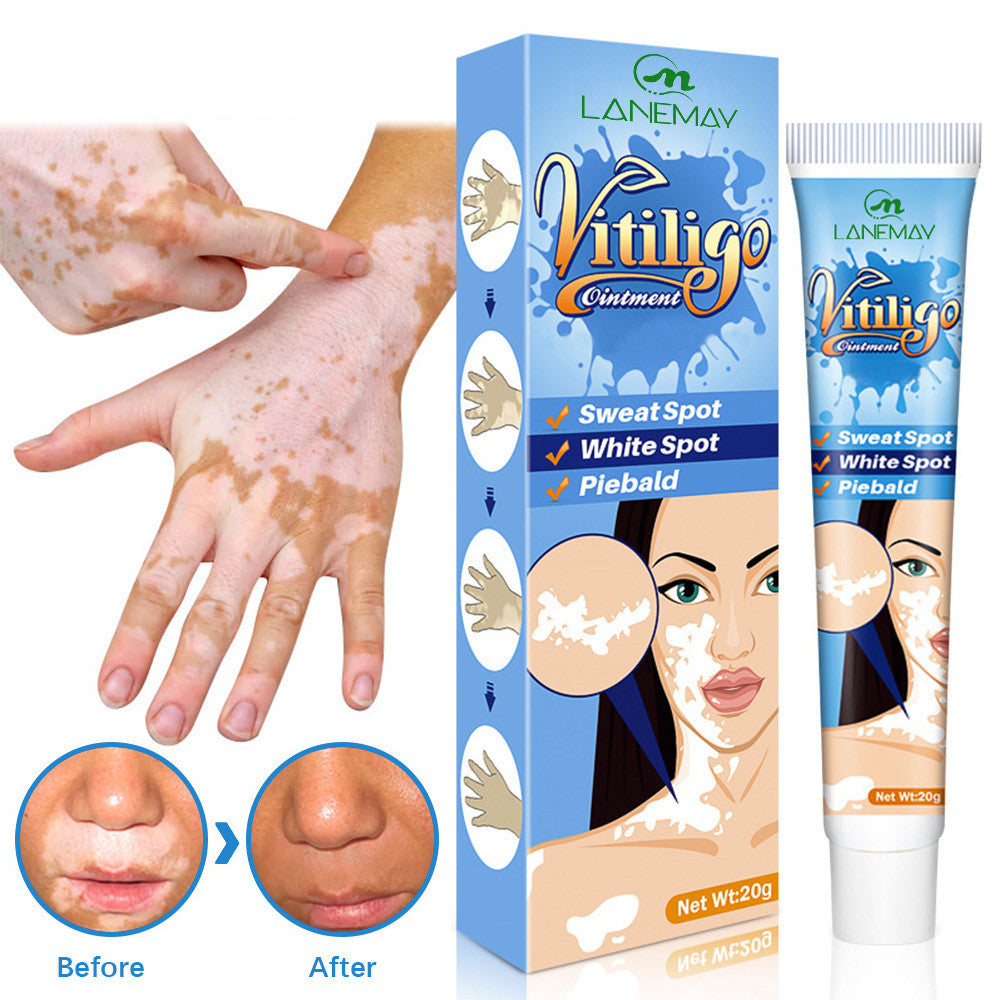 Lanemay Vitiligo Sweat Spotted Skin Care Nourishing Cream