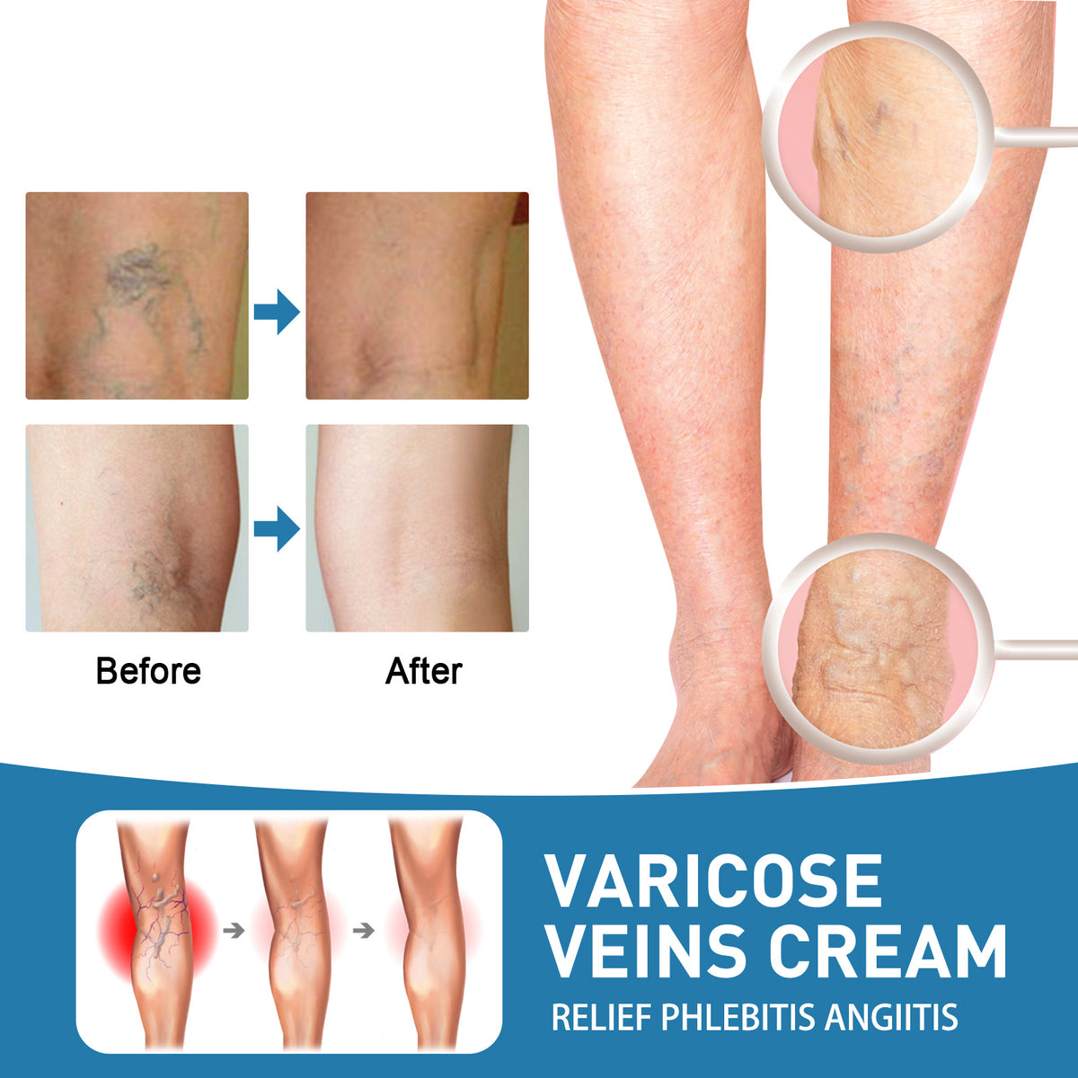 Ouhoe Intravenous Nourishing Cream Relieve Leg Leg Massage Soreness Maikang Neck Cream