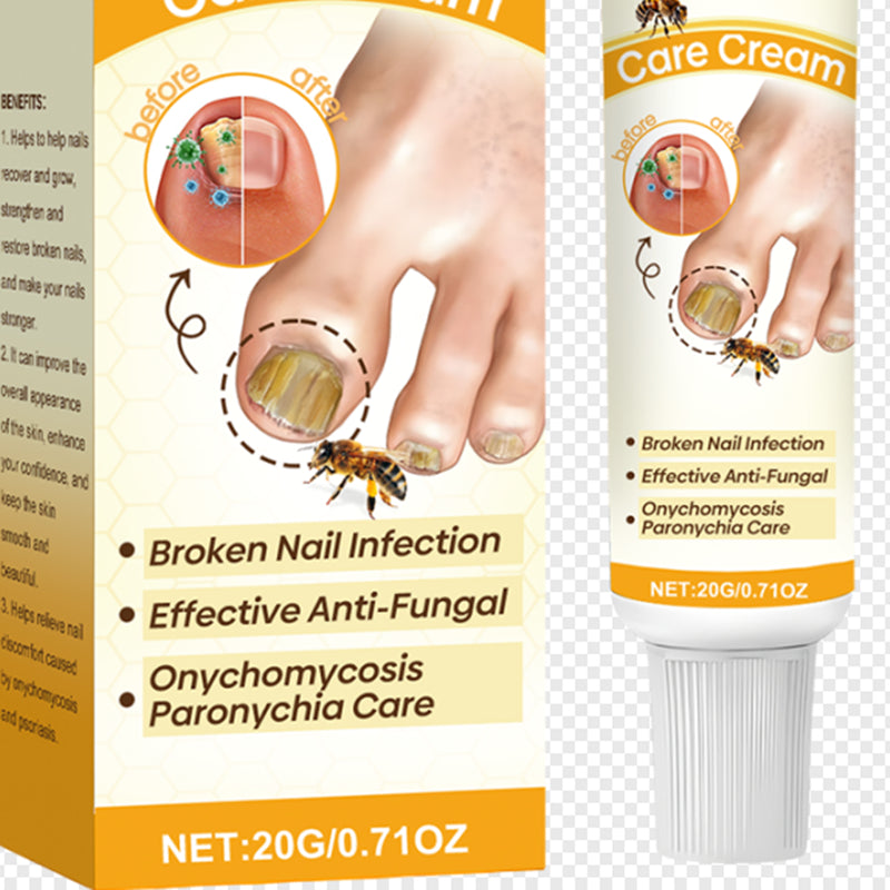 South Moon Psoriasis Care Cream For Grey Nails
