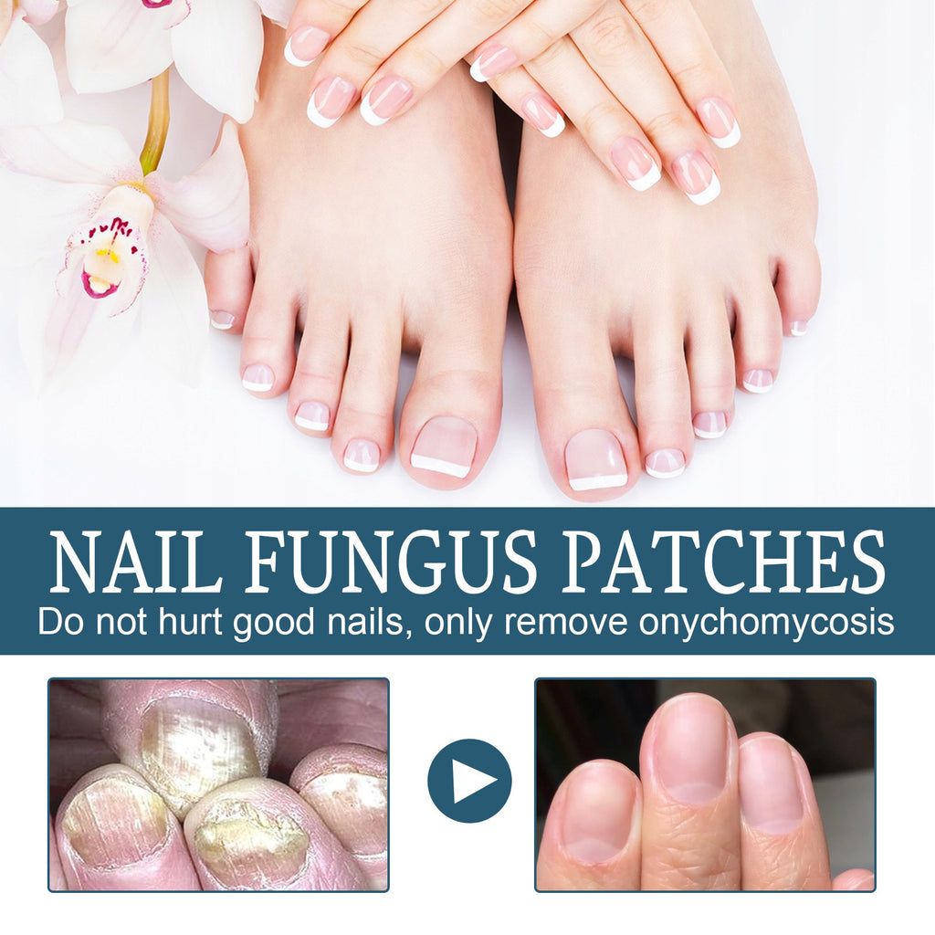 Ximonth Nail Nourishing Embedded Thickening Bright Nail