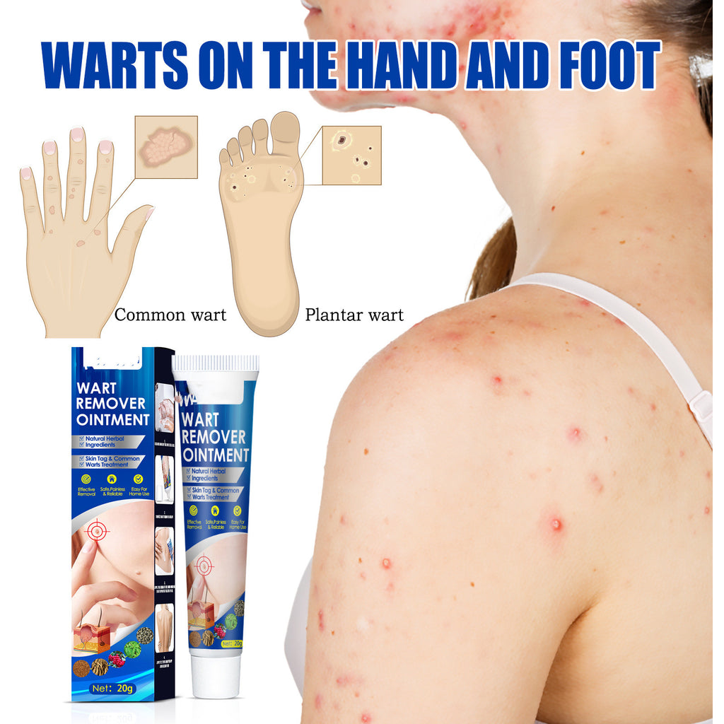 Hand Foot Face Underarm Skin Removing Cream