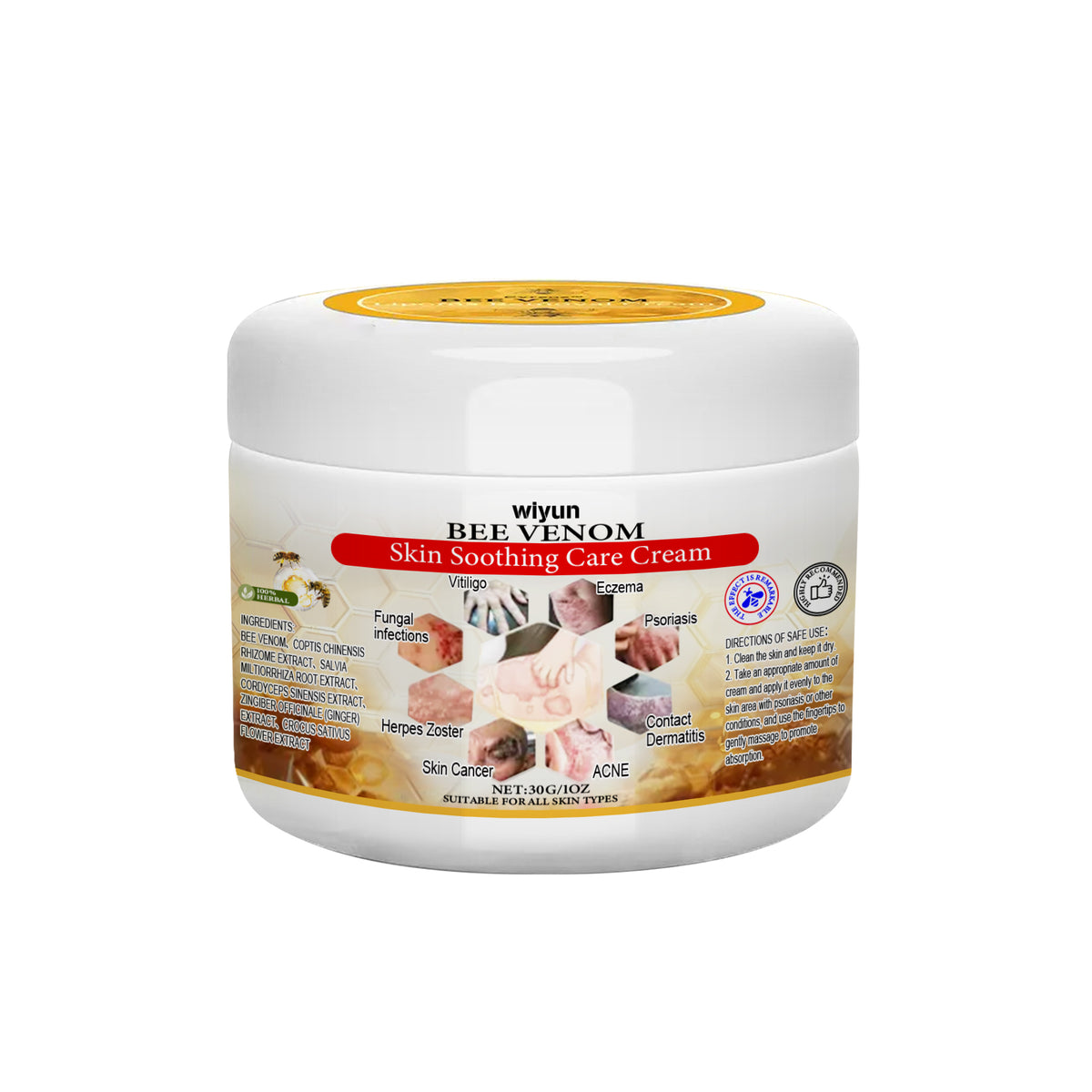 Wiyun Psoriasis Care Cream