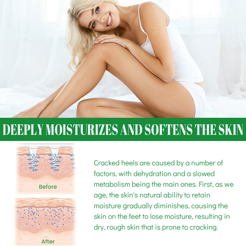 Eelhoe Deep Cleansing Foot Heel Moisturizing Cream