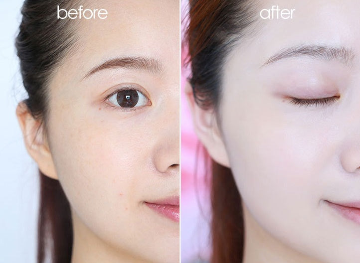 SubeYQ Freckle cream