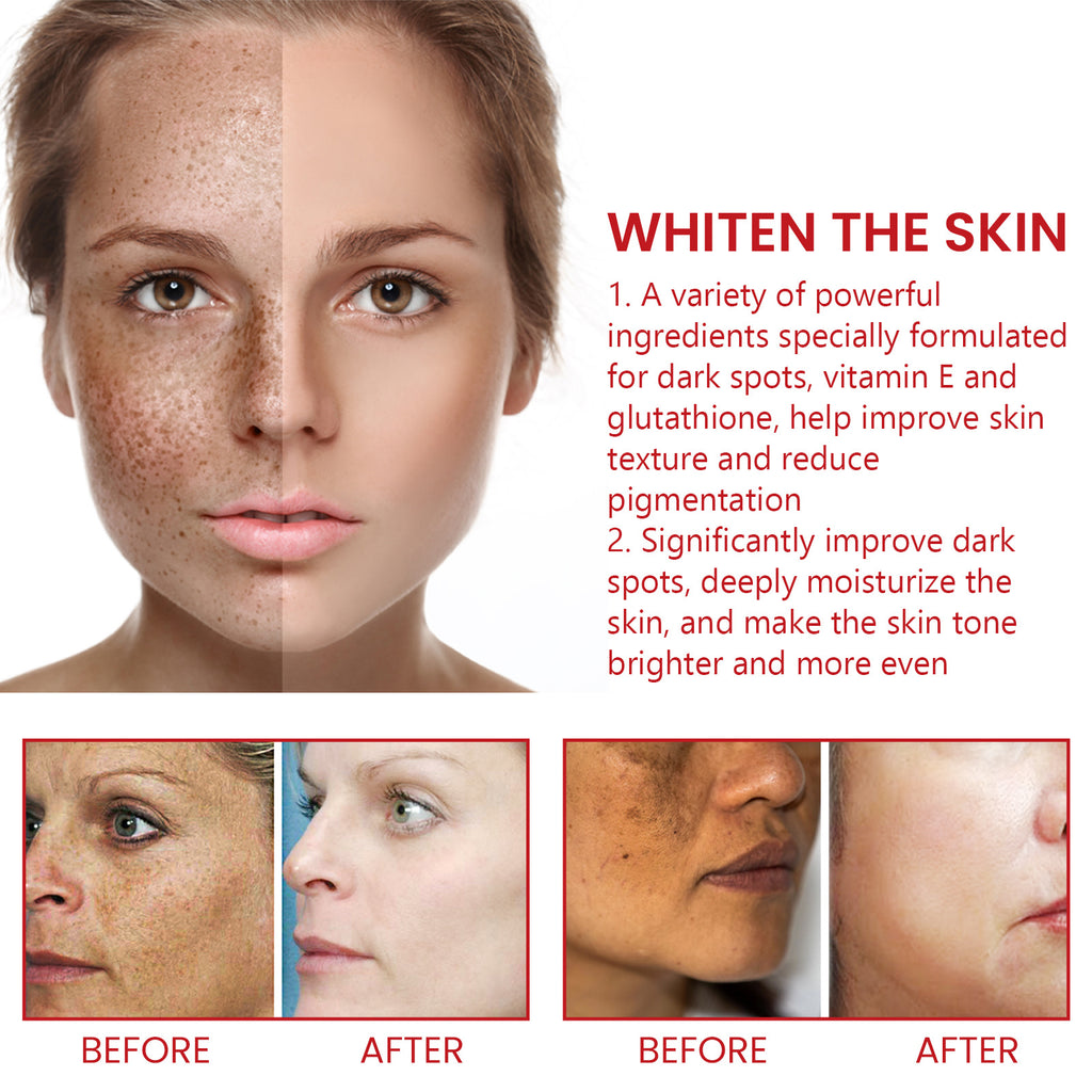 Ouhoe Black Spot Nourishing Cream Fading Wrinkle
