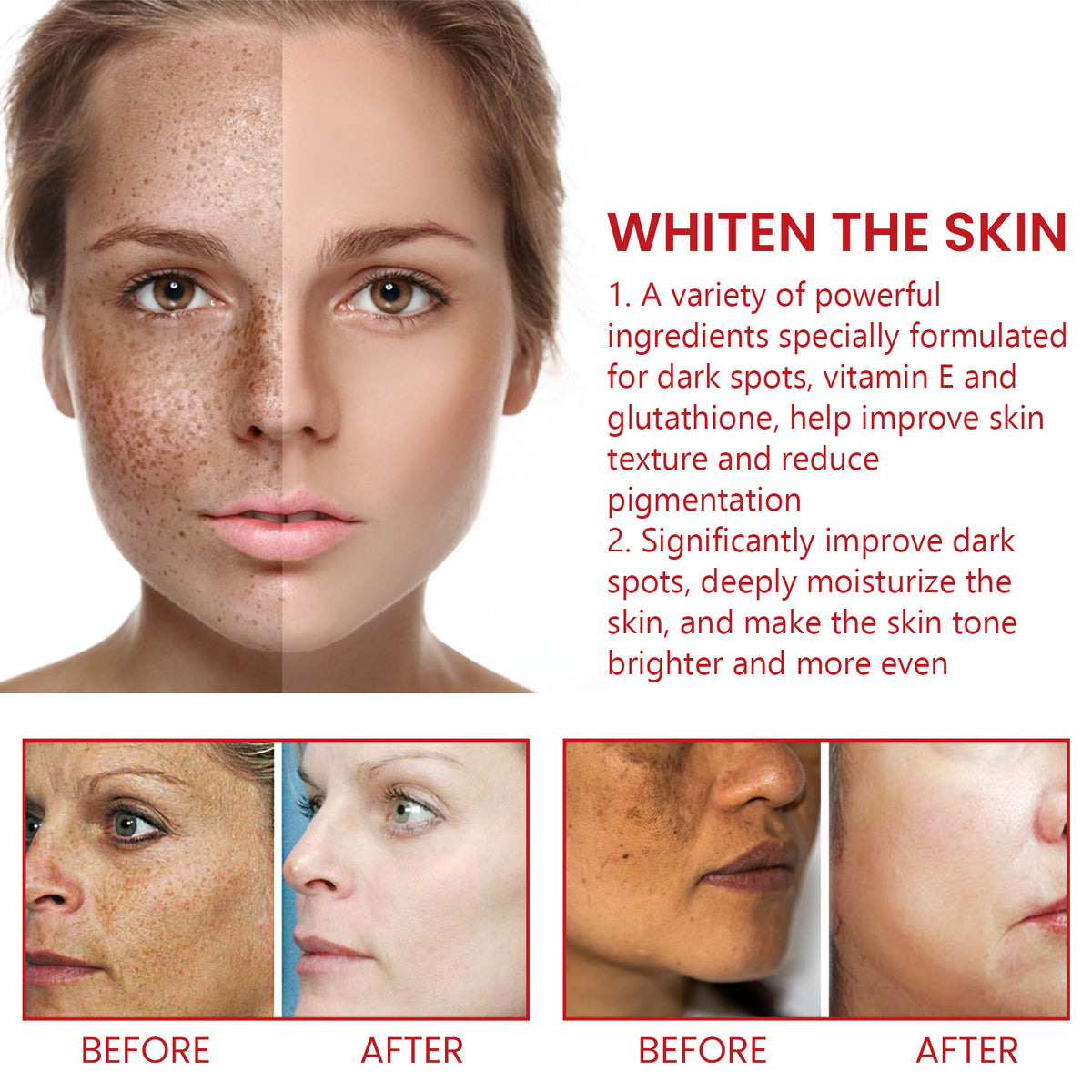Ouhoe Black Spot Nourishing Cream Fading Wrinkle